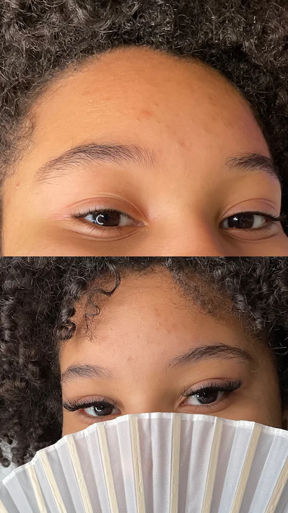 Ybonis Beauty Spa Before and After